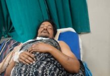 MPEBTKS : करंट पीड़ित आउटसोर्स कर्मी की मौत, इलाज के लिए परिवार पर चढ़ा कर्ज MPEBTKS